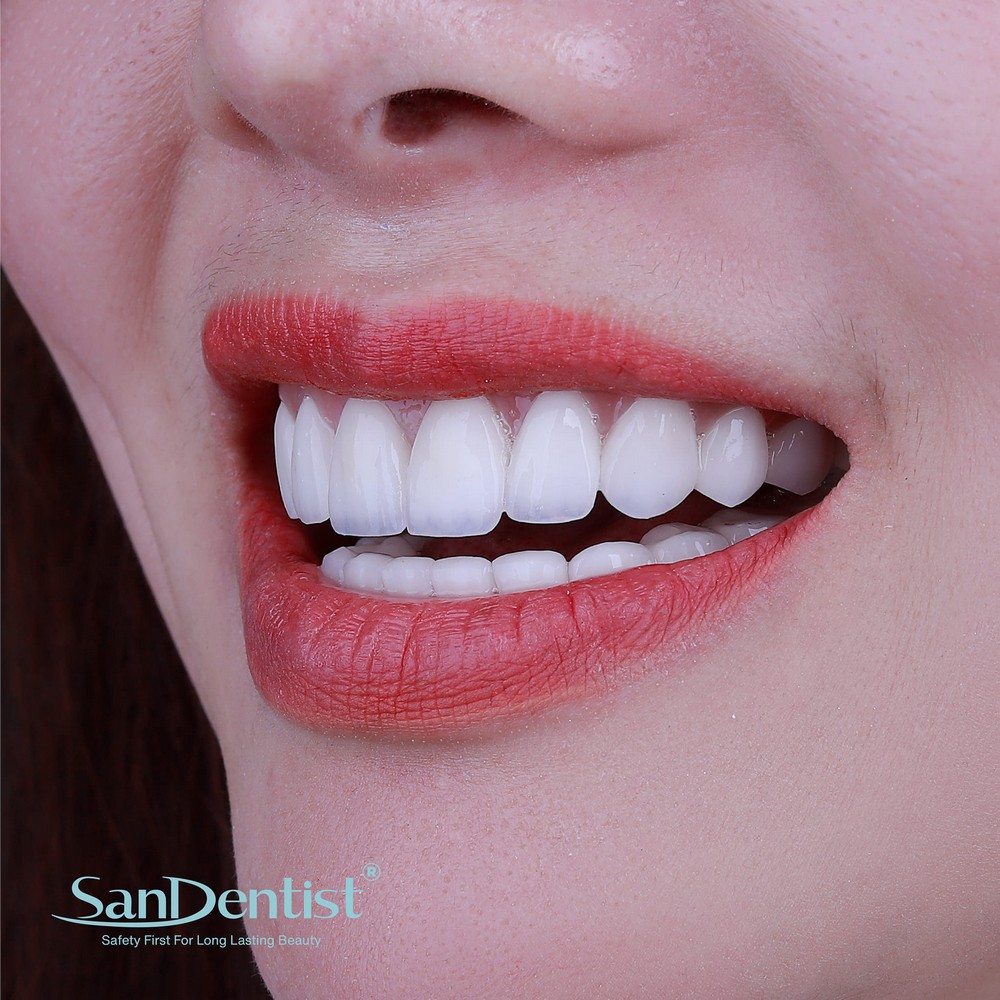 Hàm răng mọc lệch có làm "lệch" số phận?