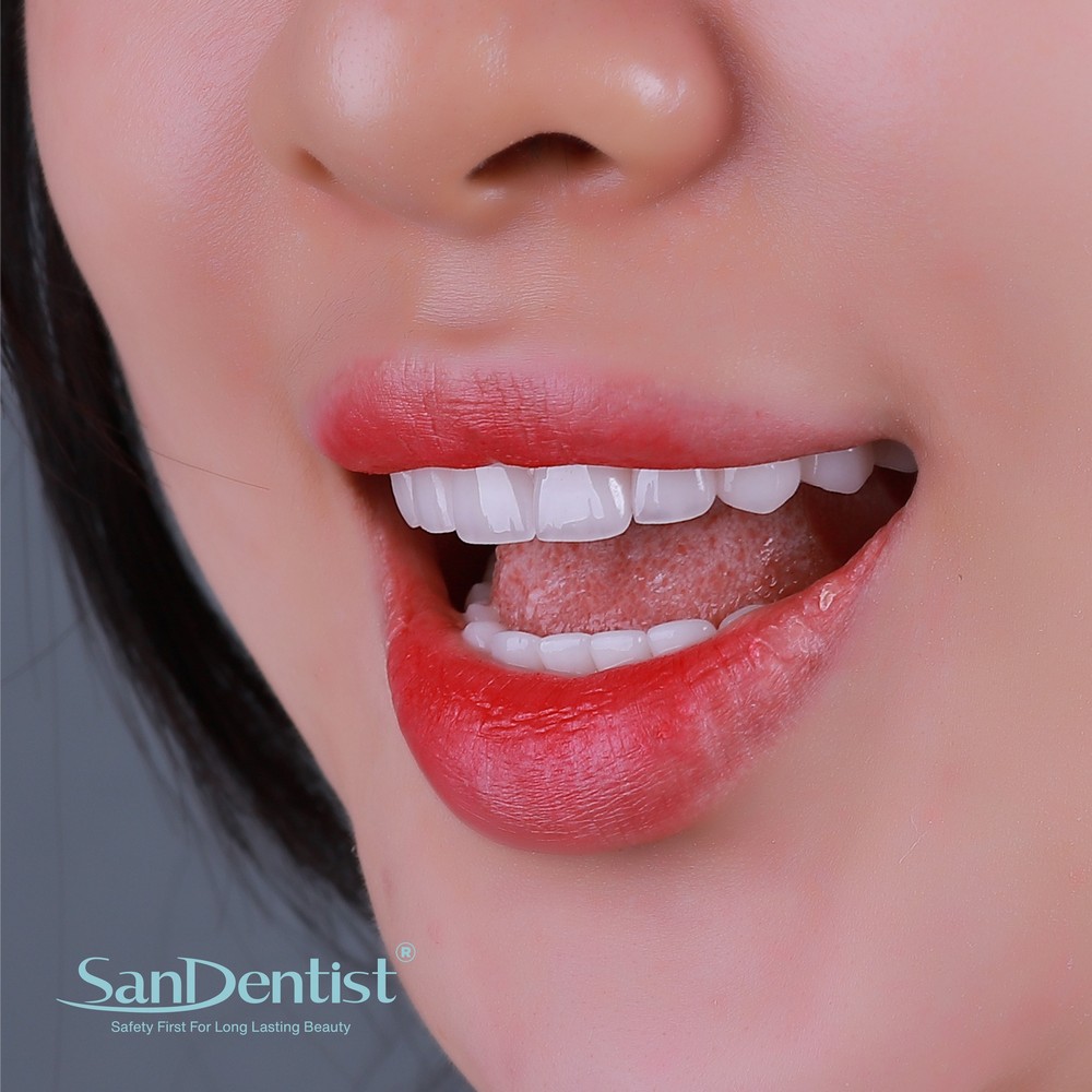 Sức khỏe răng miệng có phải do di truyền?