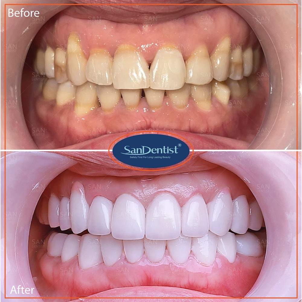 Sức khỏe răng miệng có phải do di truyền?