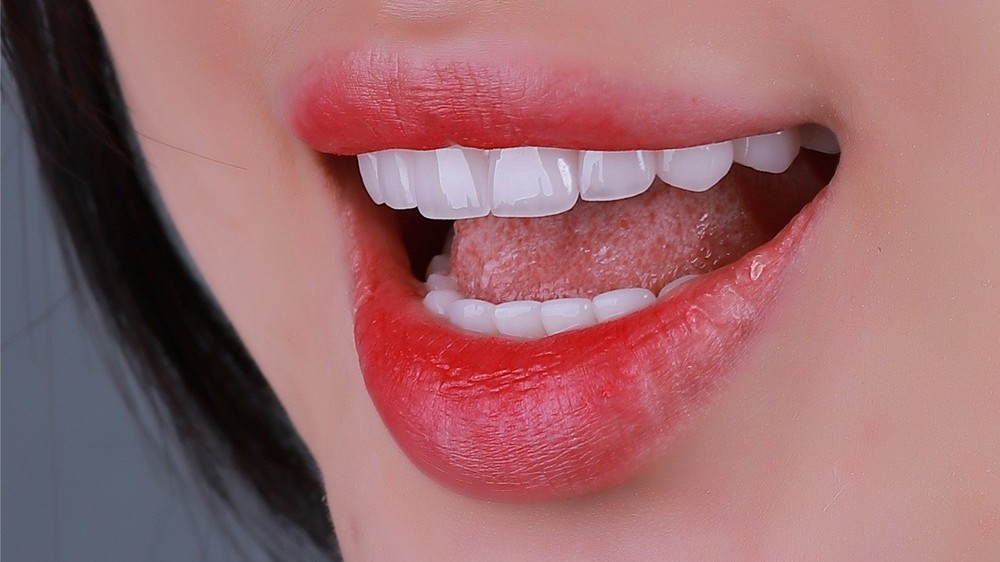 Sức khỏe răng miệng có phải do di truyền?