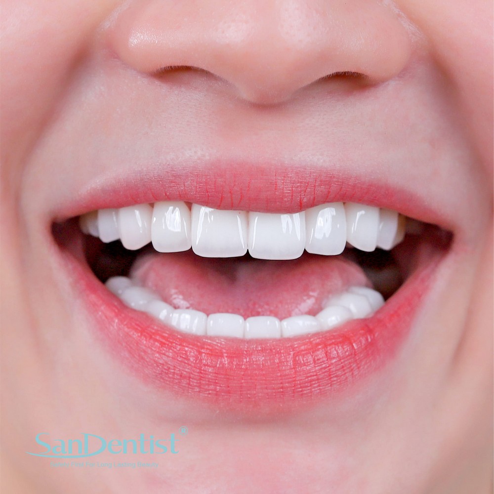 Thực hư chuyện "lên đời đổi vận" nhờ nhổ răng?