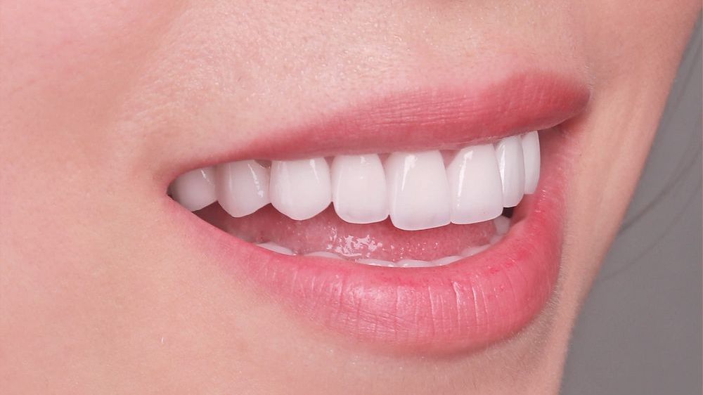 Vệ sinh răng miệng sau khi cấy ghép Implant thế nào?