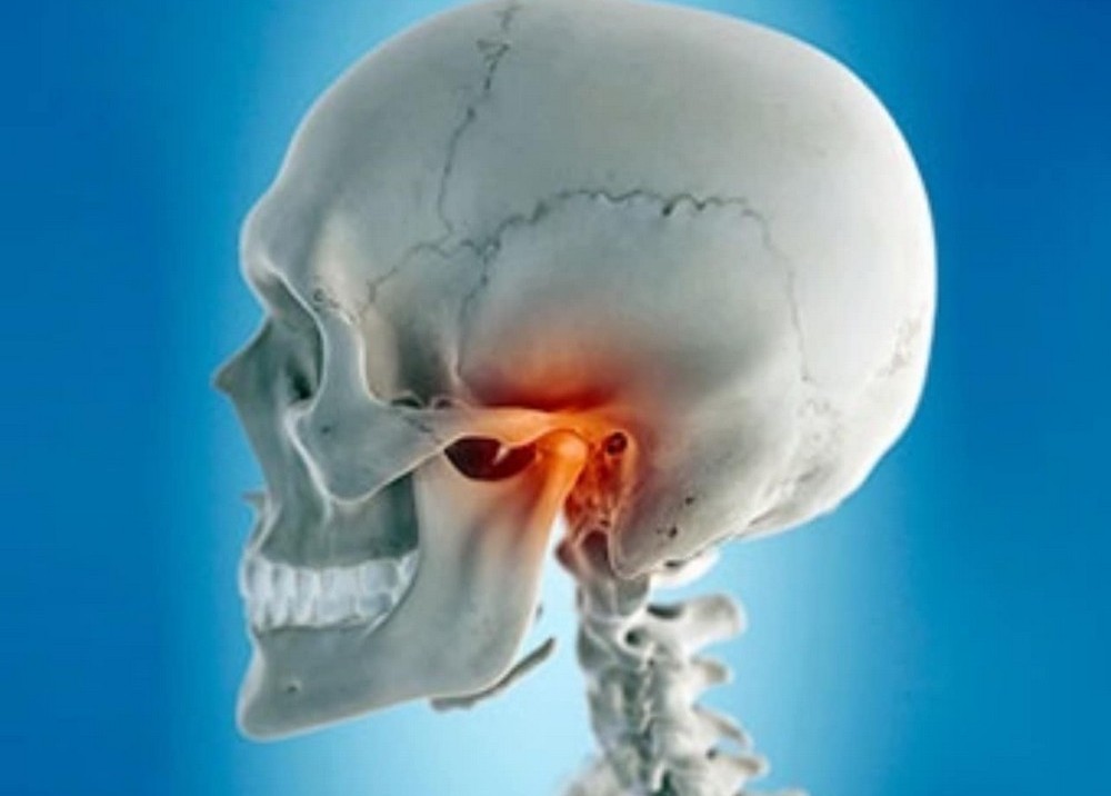 Viêm khớp thái dương hàm: Căn bệnh khiến Kasim Hoàng Vũ "méo mặt"