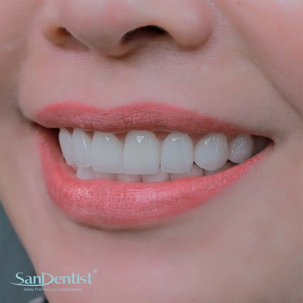 Bệnh viêm chân răng: Nguyên nhân và cách điều trị