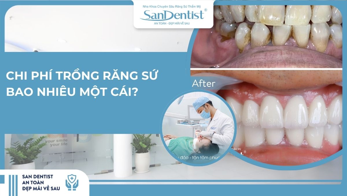 Chi phí trồng răng sứ bao nhiêu một cái