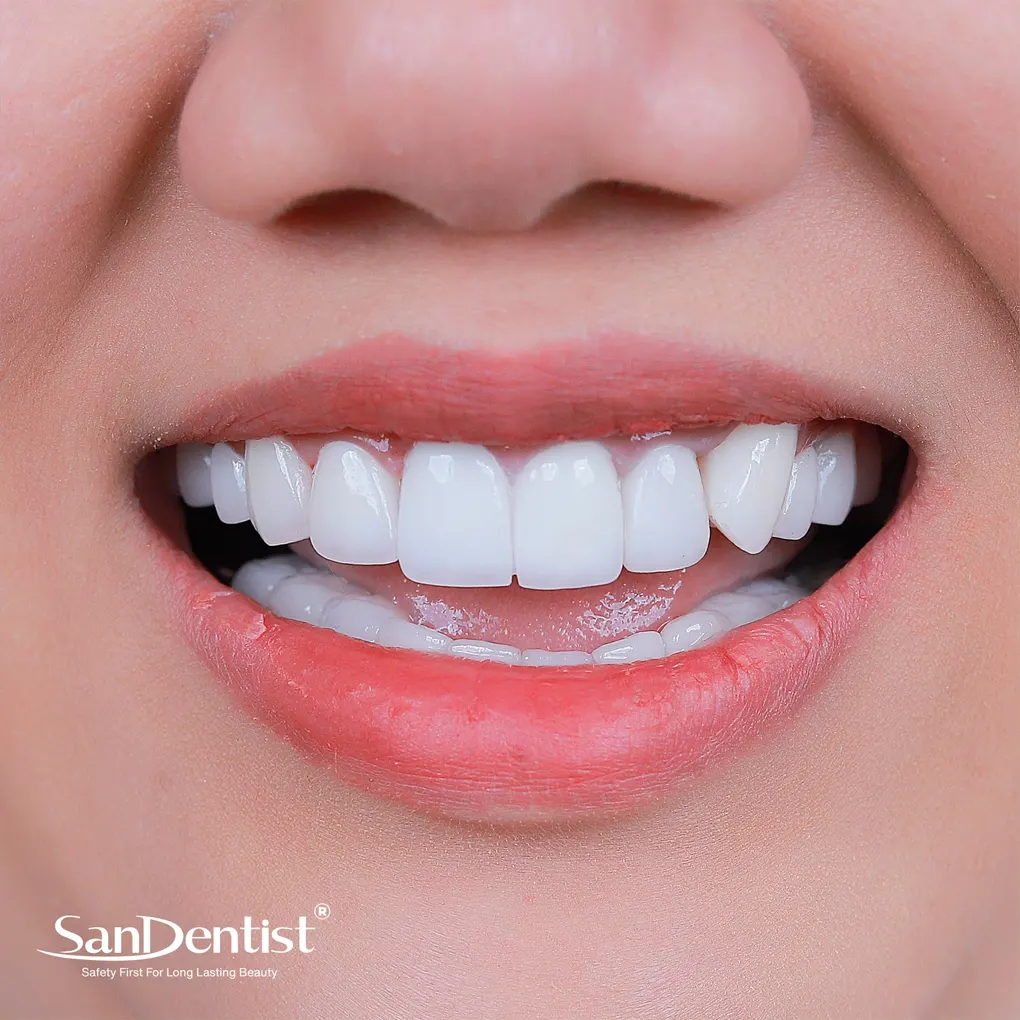 Hôi miệng từ cổ họng có ảnh hưởng gì không?