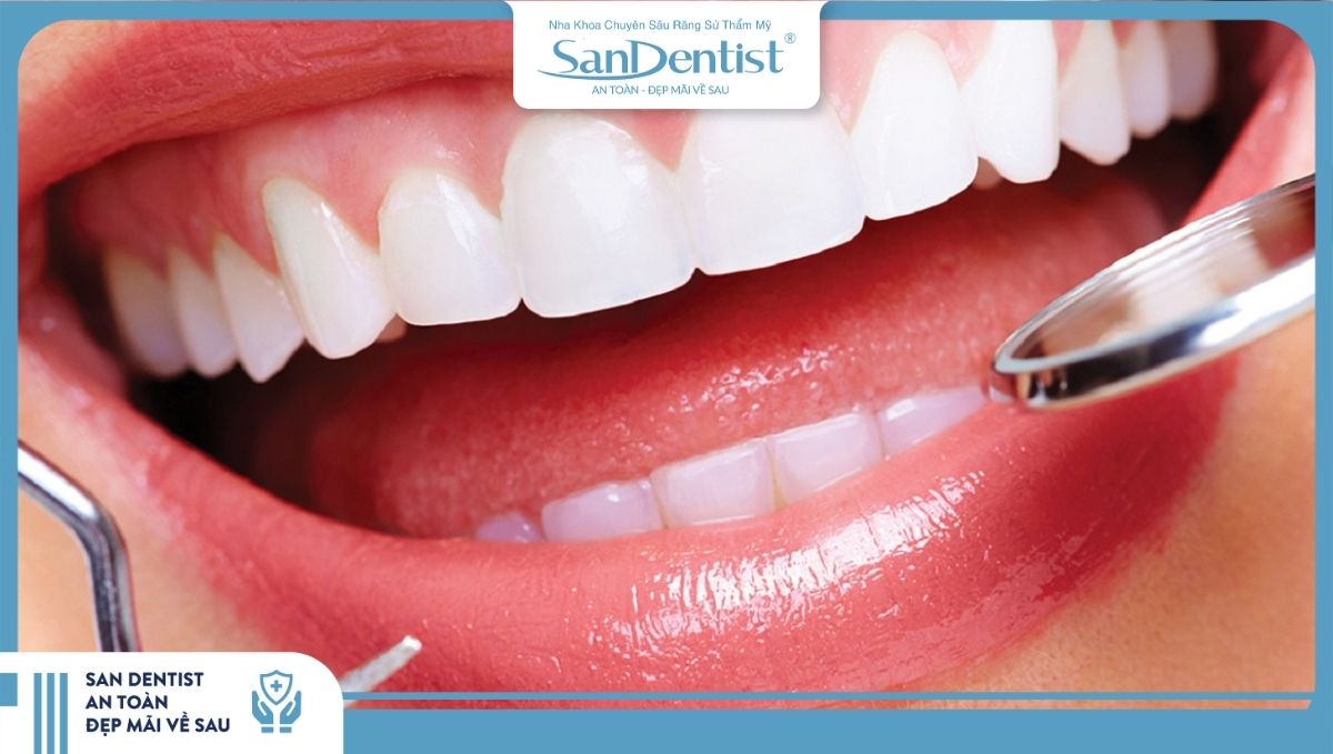 Làm một cái răng sứ bao nhiêu tiền sẽ tùy thuộc vào phương pháp mà người bệnh lựa chọn