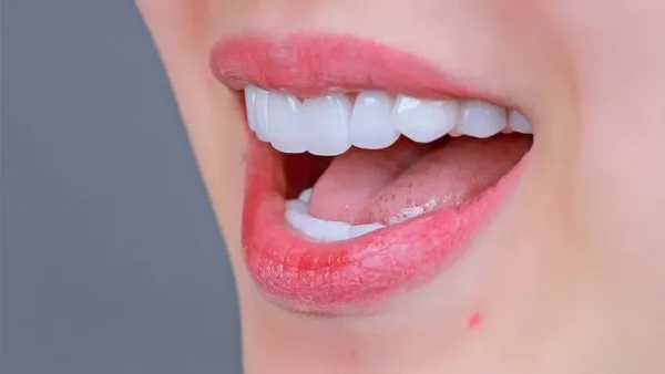 Những điều cần lưu ý trong việc trồng răng khểnh