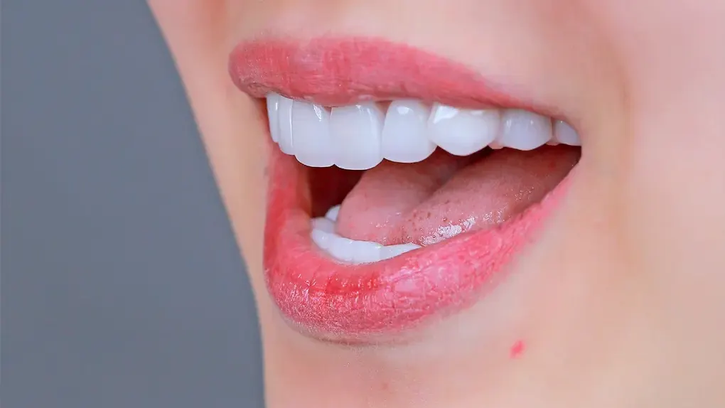 Những điều cần lưu ý trong việc trồng răng khểnh