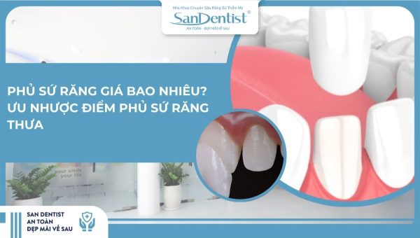 Phủ sứ răng giá bao nhiêu_ Ưu nhược điểm phủ sứ răng thưa