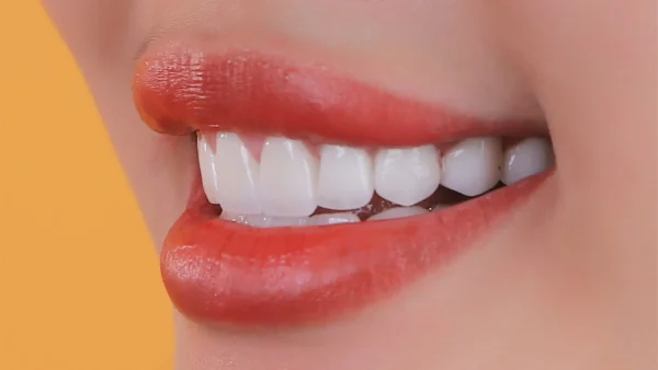 Quy trình chỉnh hàm lệch đúng chuẩn y khoa