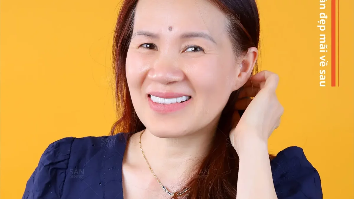 Tìm hiểu về phương pháp trồng răng vĩnh viễn