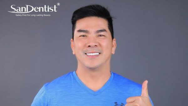 Chân răng bị vàng: Điều trị ra sao để lấy lại vẻ đẹp?