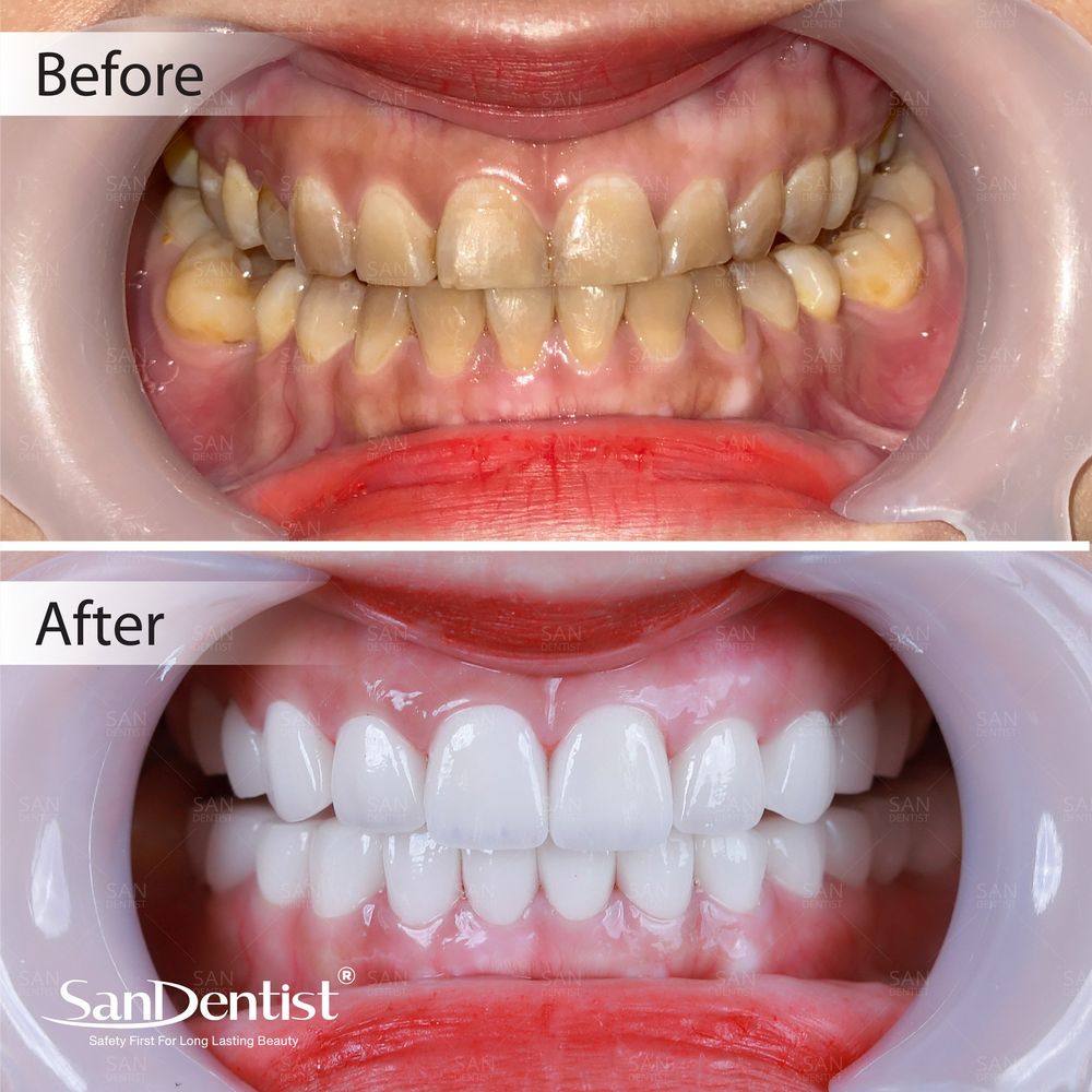 Cây bạc hà: Thần dược chăm sóc răng miệng!