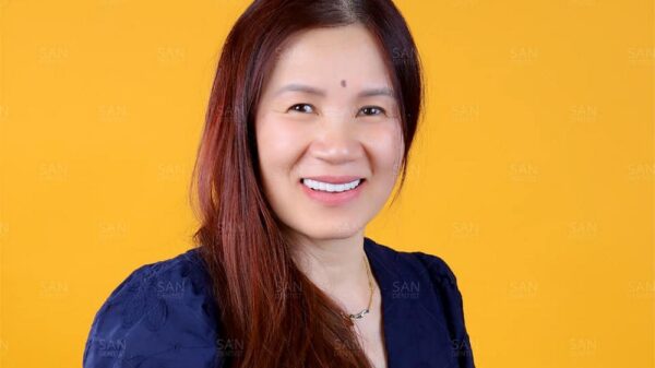 Cạo vôi đánh bóng răng cần lưu ý gì?