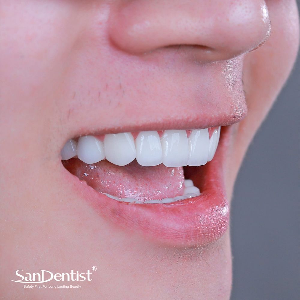 Phẫu thuật hàm móm có nguy hiểm gì không?