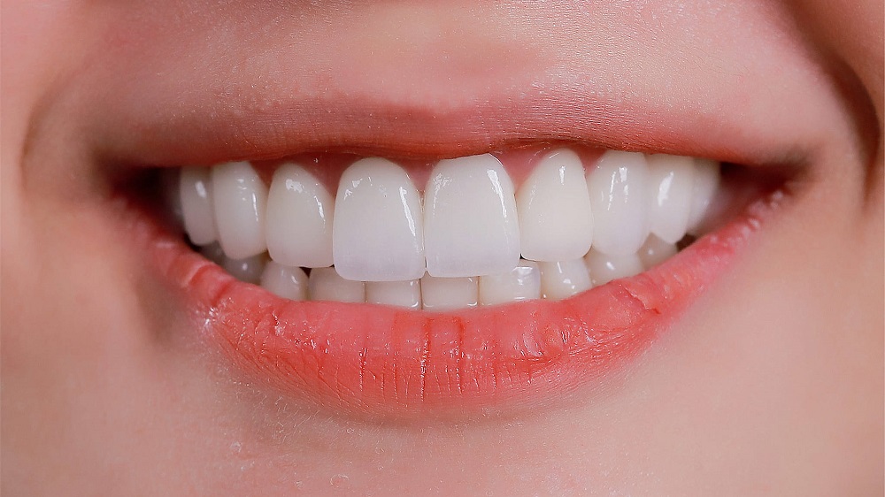 Phủ răng sứ cho trẻ em: Có nên thực hiện không?