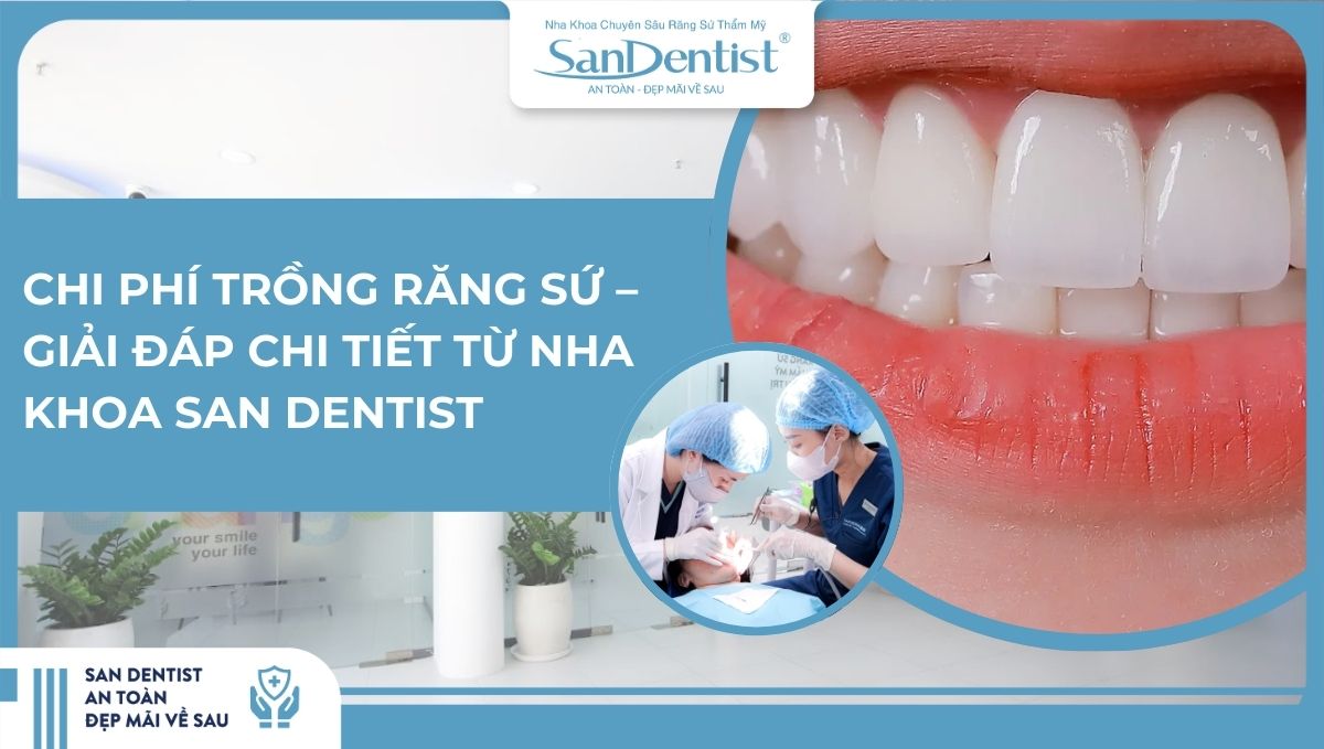 Chi phí trồng răng sứ – Giải đáp chi tiết từ Nha khoa San Dentist