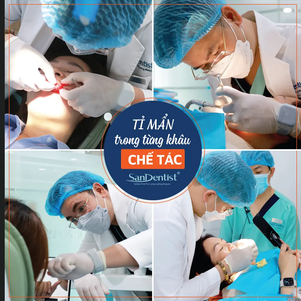 Dán sứ veneer có mài răng hay không?