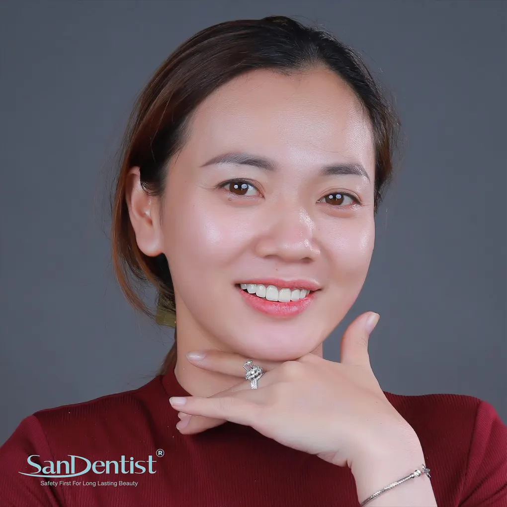 Lấy cao răng có điều trị hôi miệng được không?