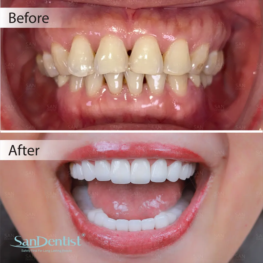 Nhận biết các vấn đề về răng miệng gây đau đầu