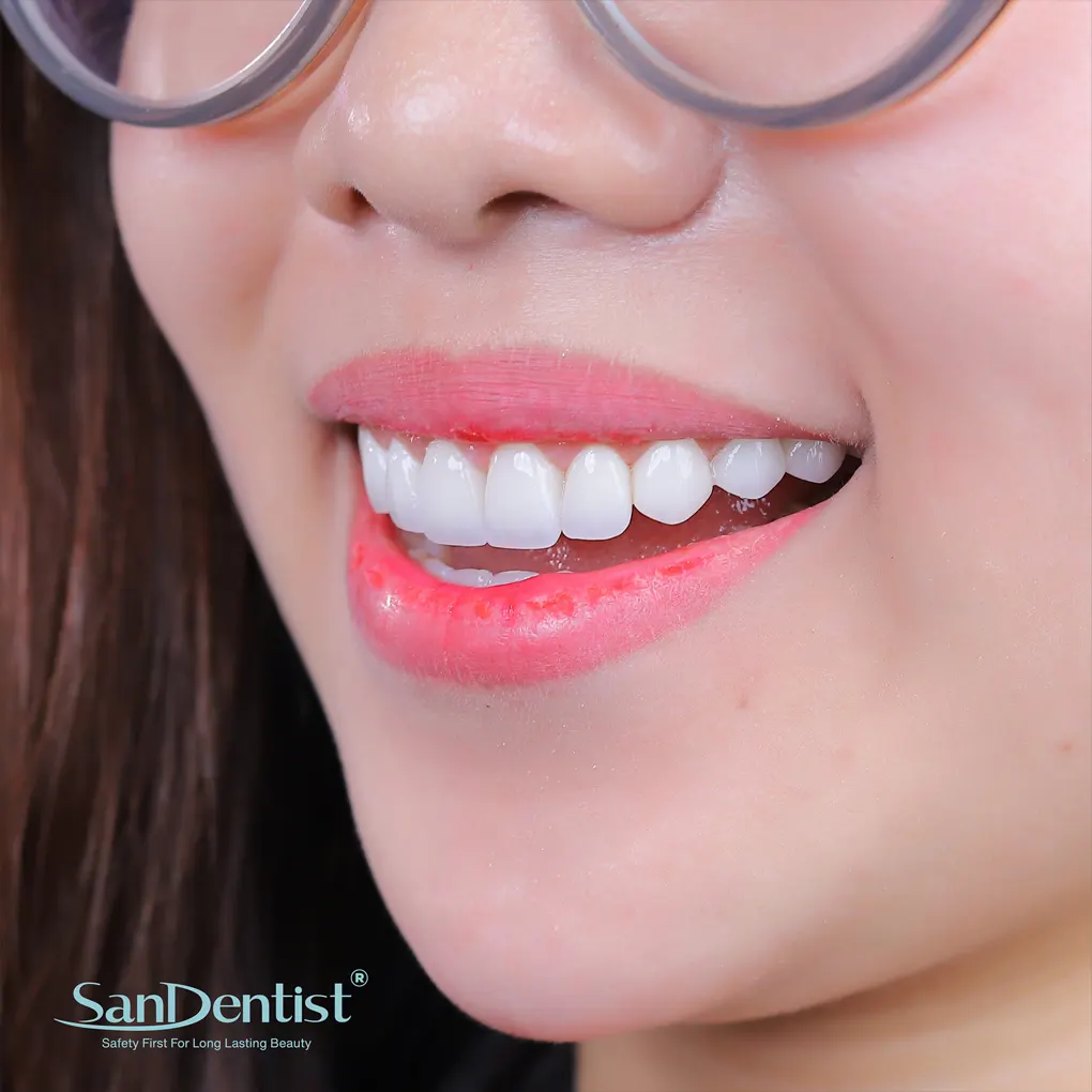 Sâu răng hàm: Nguy hiểm không lường đến sức khỏe