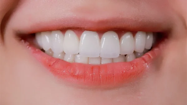 Thủ phạm không ngờ gây phá hủy hàm răng của bạn