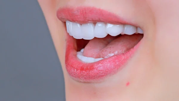 5 cách lấy cao răng đơn giản tại nhà