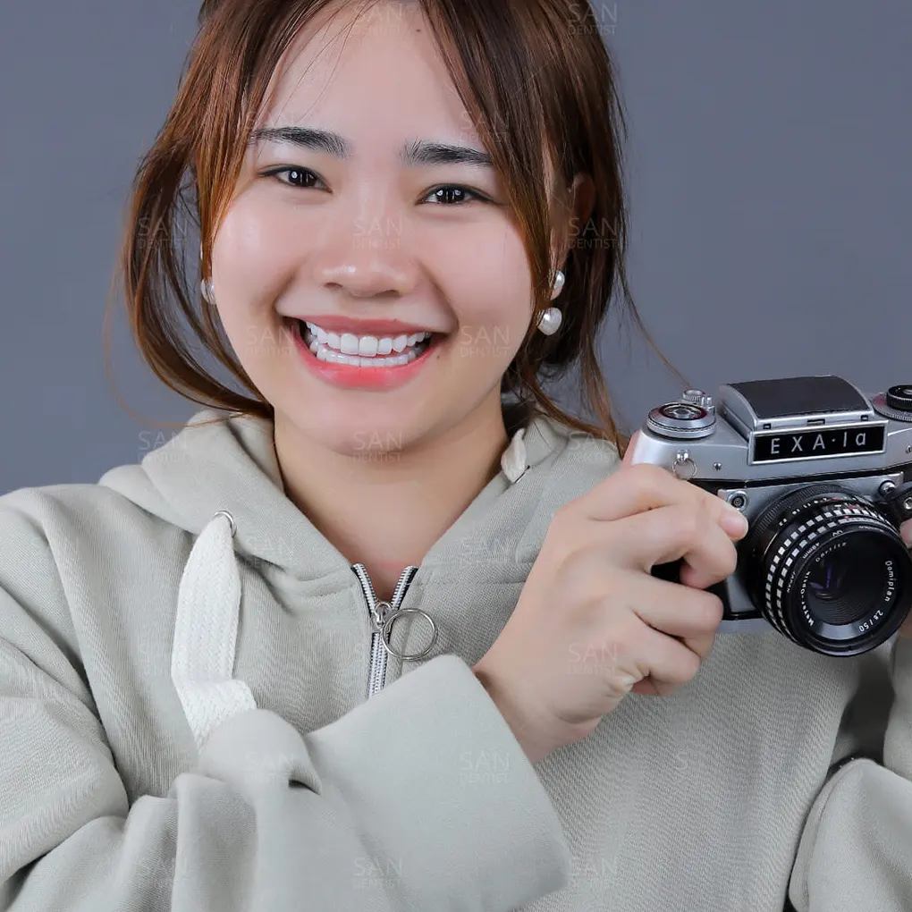 Bí quyết sau nhổ răng khôn hồi phục nhanh chóng