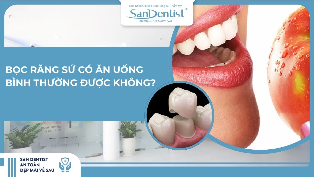 Bọc răng sứ có ăn uống bình thường được không