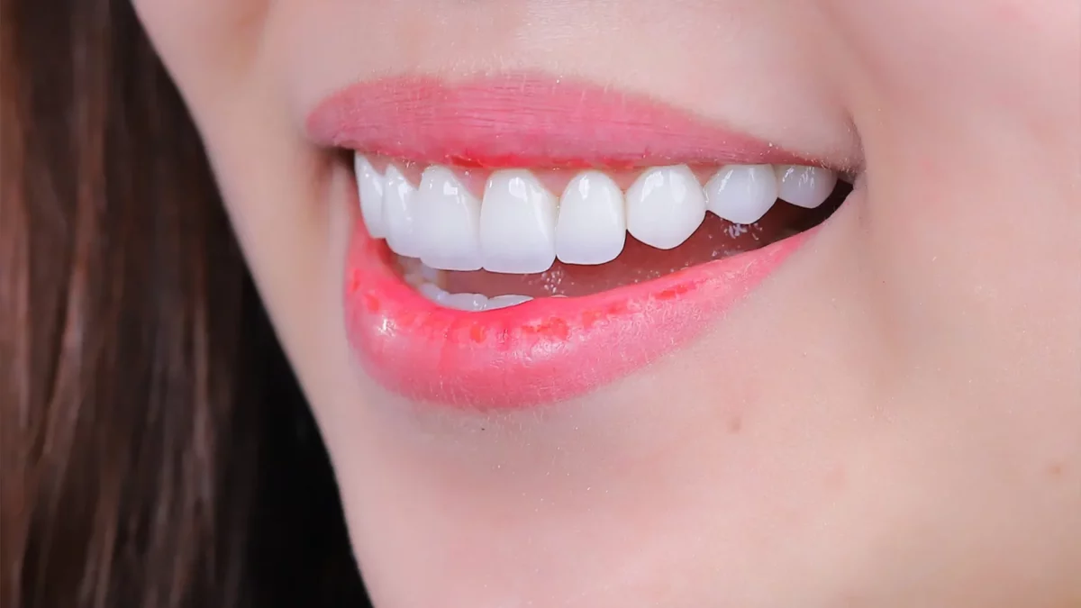 Điều trị dứt điểm tình trạng hôi miệng kinh niên