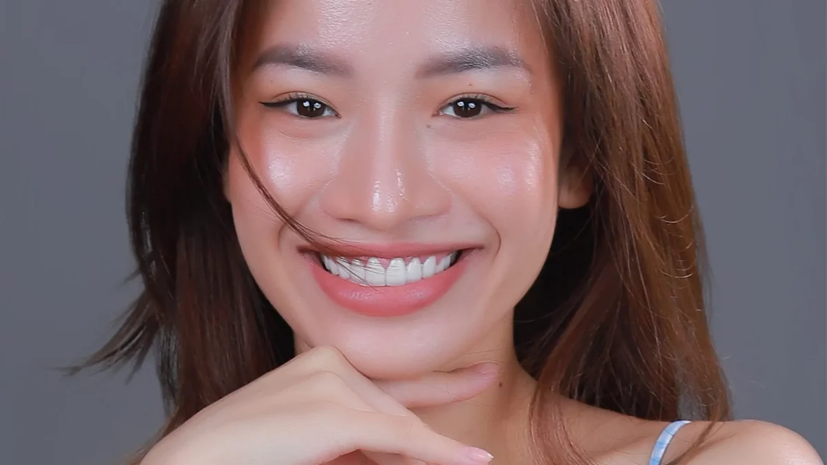 Điều trị tủy răng sâu kết hợp phủ răng sứ được không?