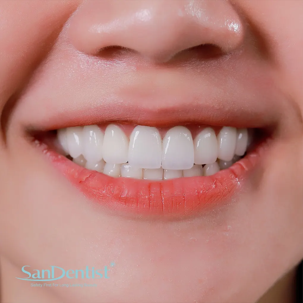 Vệ sinh răng miệng kém sẽ dẫn đến bệnh nan y