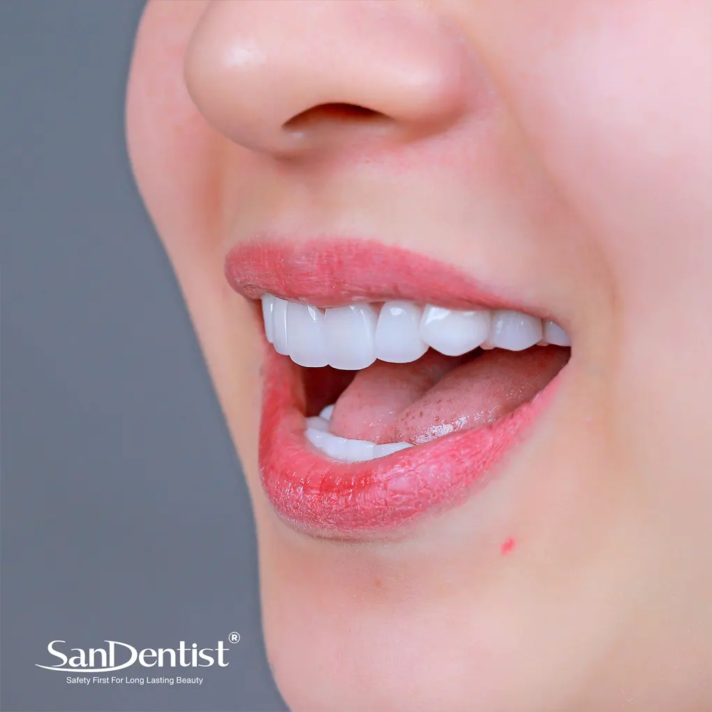 Viêm lợi có phải nhổ bỏ răng hay không?