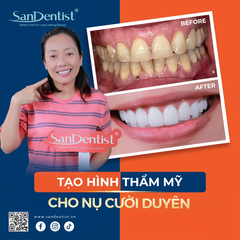 7 thói quen xấu khiến răng ố vàng