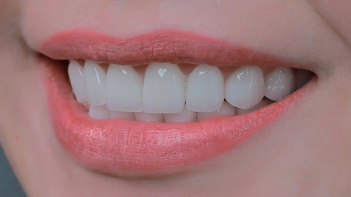 Cách khắc phục tình trạng chảy máu khi phủ răng sứ