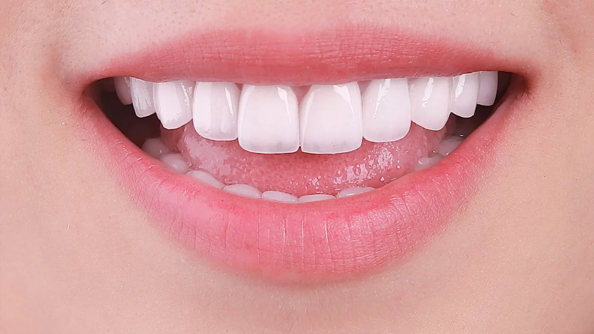 Hậu quả của tình trạng răng bị mài mòn mặt nhai