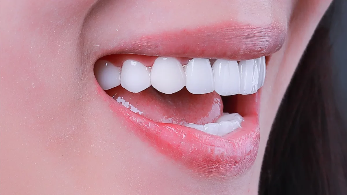 Những điều cần lưu ý về vôi hóa tuyến nước bọt