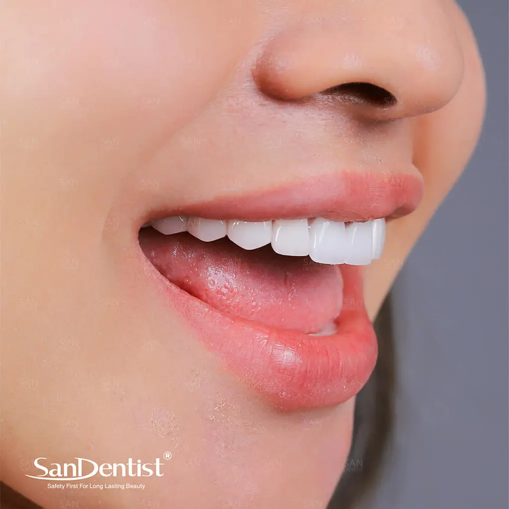 Răng chết tủy: Dấu hiệu và cách điều trị?