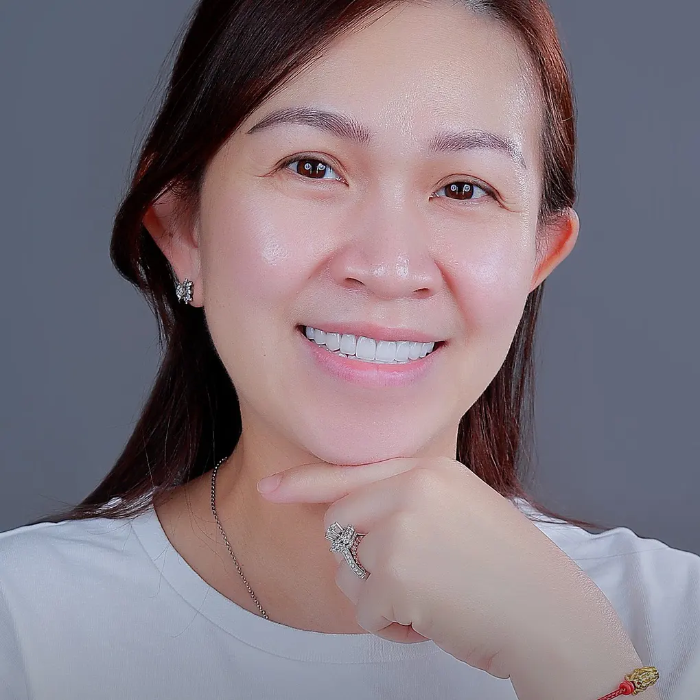 Răng lệch khớp cắn gây ra những tác hại gì?