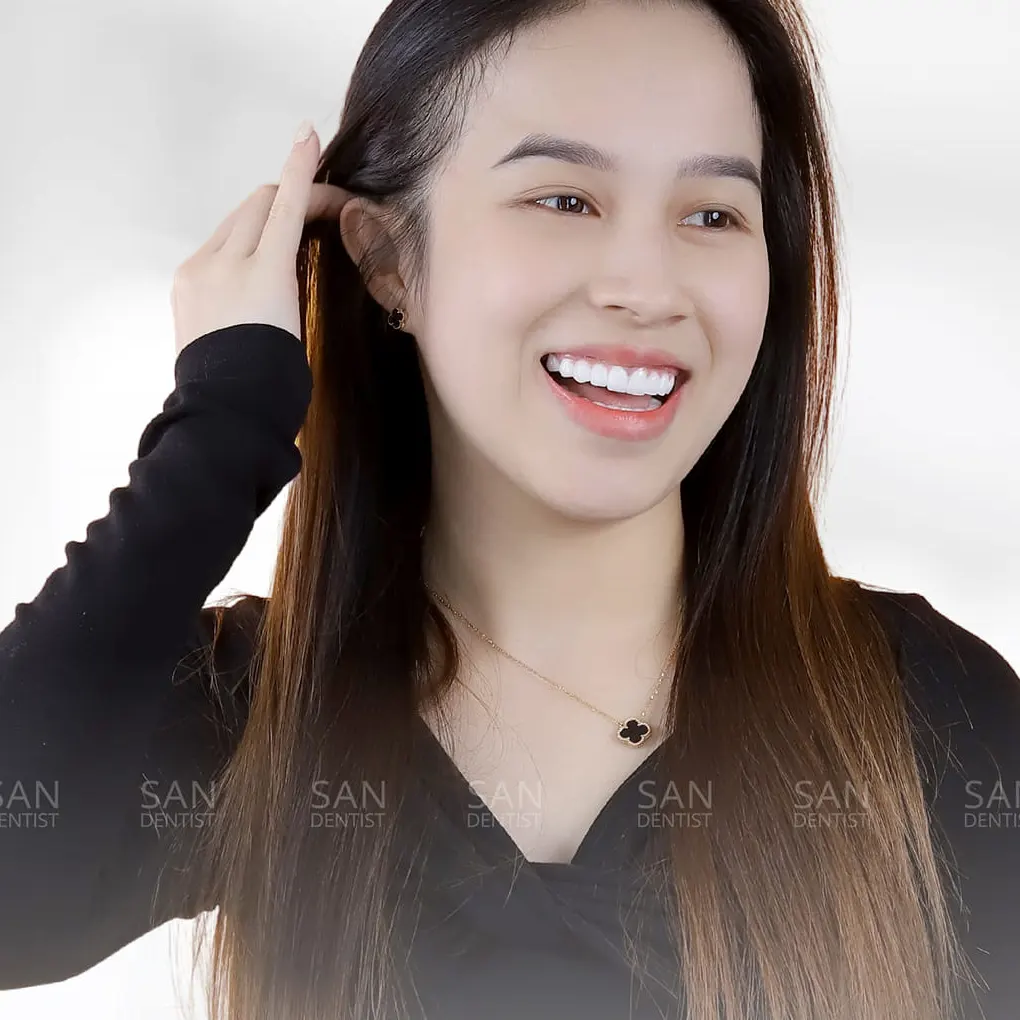 Bị sốt và đau đầu sau nhổ răng xử lý như thế nào?