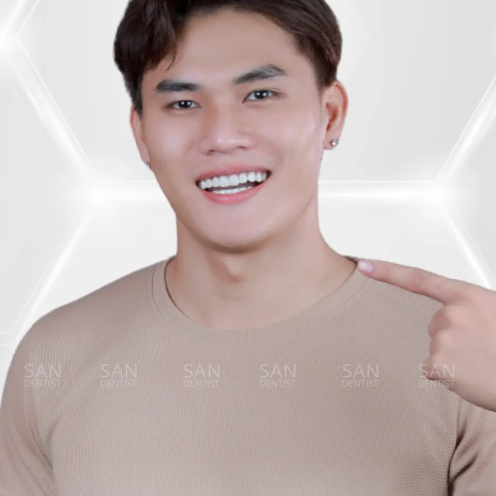 Bị sốt và đau đầu sau nhổ răng xử lý như thế nào?