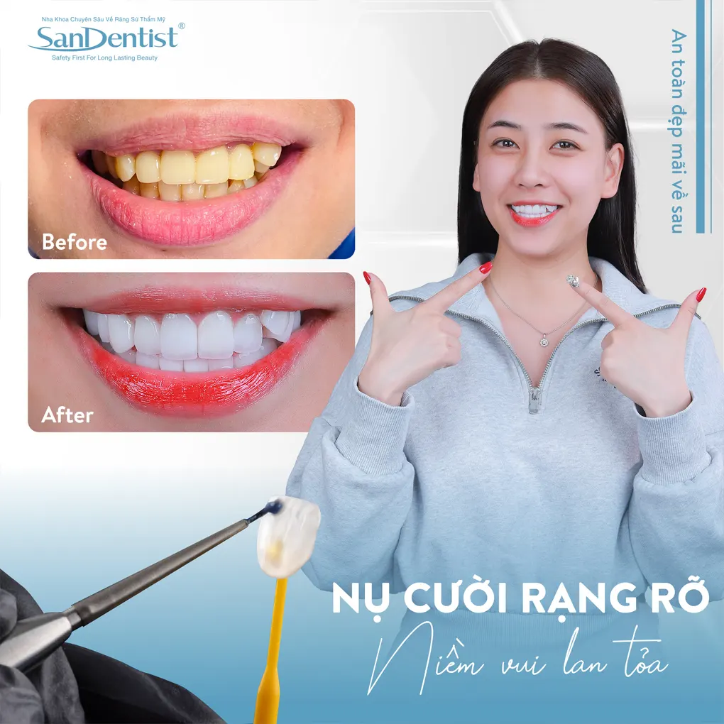 Biện pháp ngăn chặn tình trạng chảy máu răng 