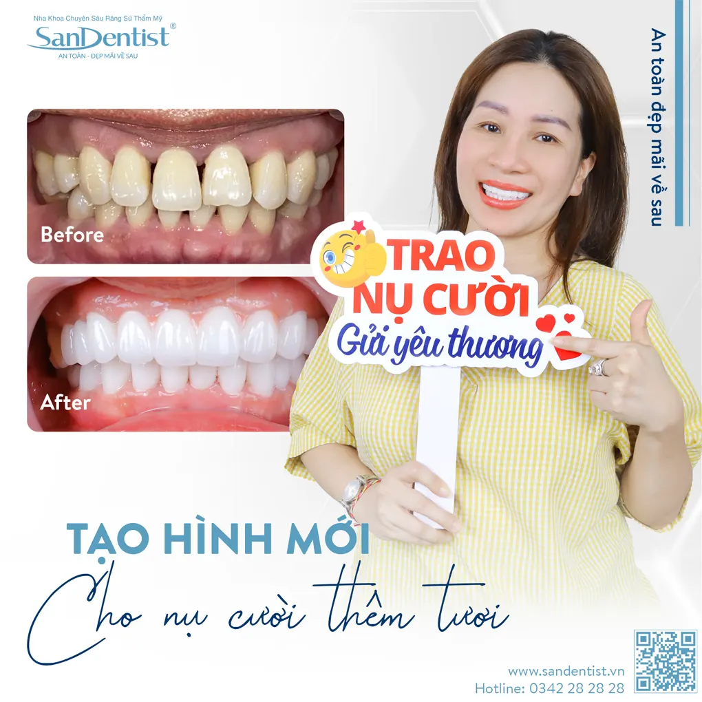 Cách khắc phục đau nhức sau phủ răng sứ
