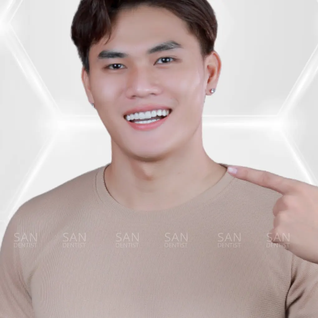 Cách khắc phục tình trạng răng cao răng thấp