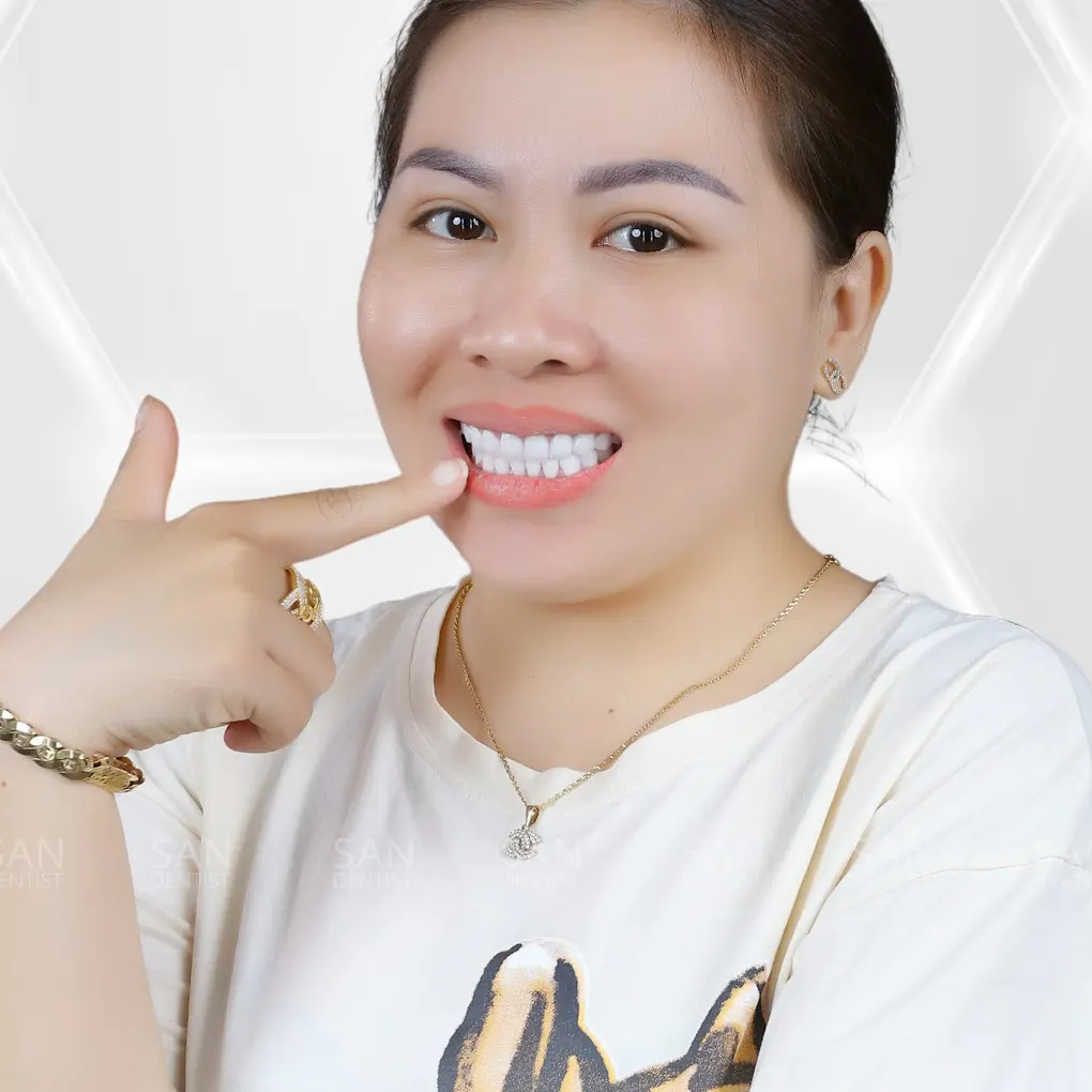 Cách nhận biết các loại răng giả cao cấp