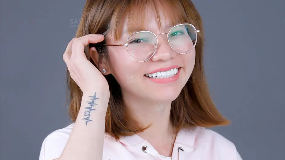 Cách tẩy trắng răng không tốn nhiều chi phí