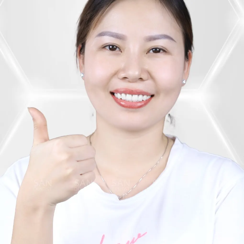 Cao răng cấp độ 3 nguy hiểm như thế nào?