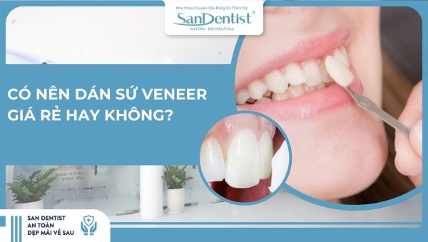 Có nên dán sứ Veneer giá rẻ hay không