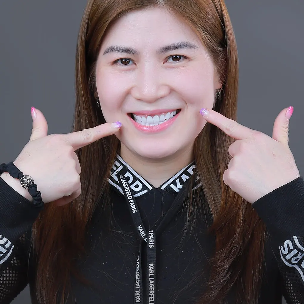 Công dụng của phương pháp hàn răng tạm thời